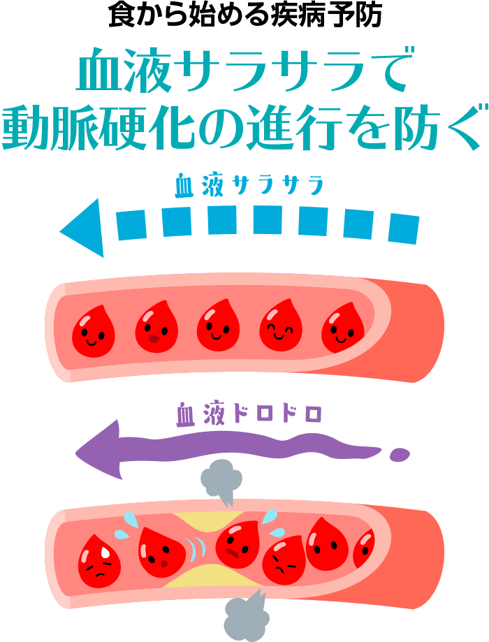 血液サラサラで動脈硬化の進行を防ぐ