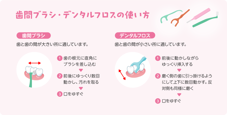 歯間ブラシ・デンタルフロスの使い方